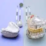 Immediate vs. Complete Dentures 150x150 1