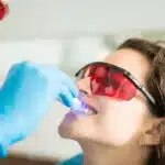 Internal Bleaching 150x150 1