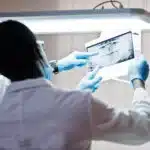 Oral Cancer Screening 150x150 1