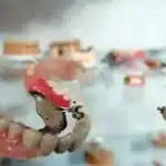 Partial Dentures 150x150 1