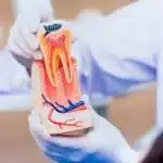 Root Canal Therapy 150x150 1