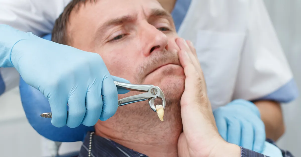 tooth extraction
